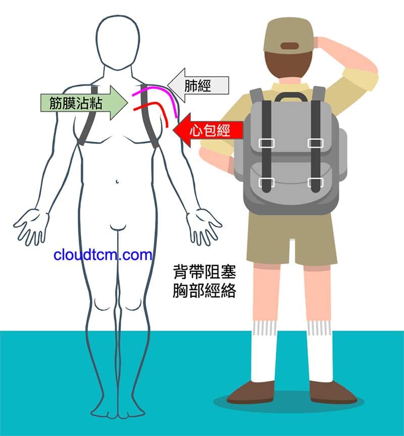 經常揹著過重的背包，會讓胸部經絡氣血阻塞