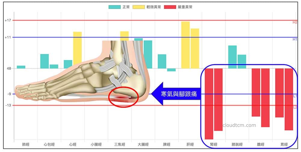 冬天常見的經絡型態，可以清楚看出寒氣與腳跟痛的關係