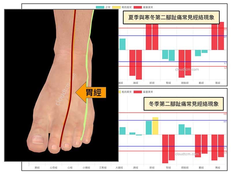 炎熱夏季與冬季12月，有機會出現第二腳趾痛