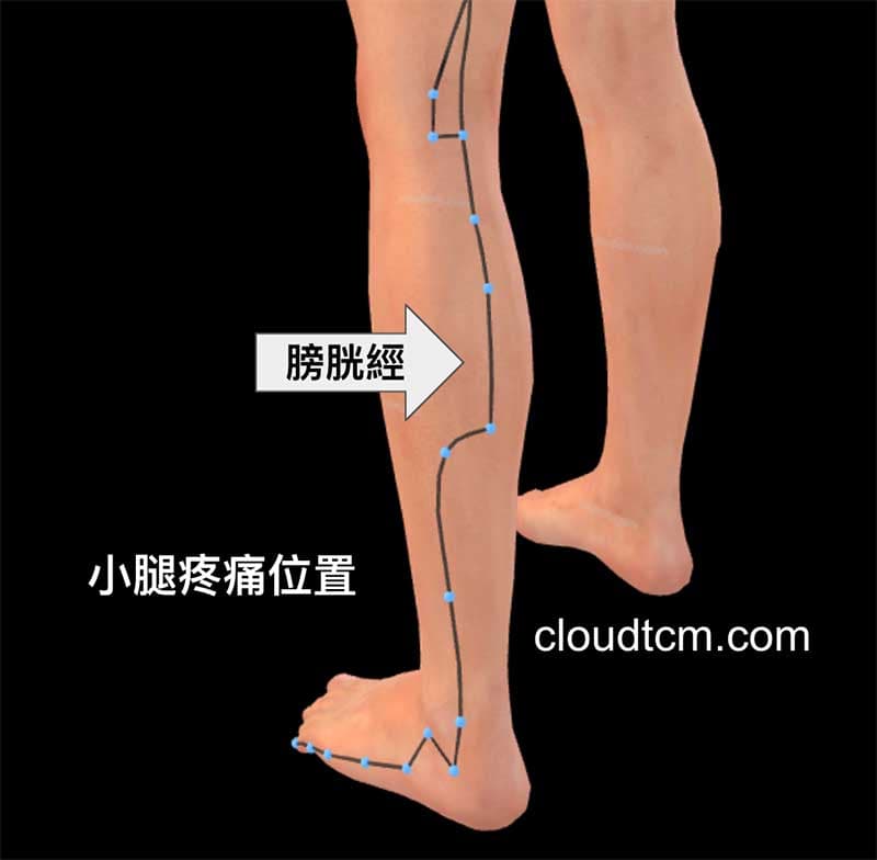 小腿痛位於膀胱經路線上