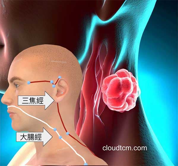 頸部腫瘤與三焦經大腸經的關係